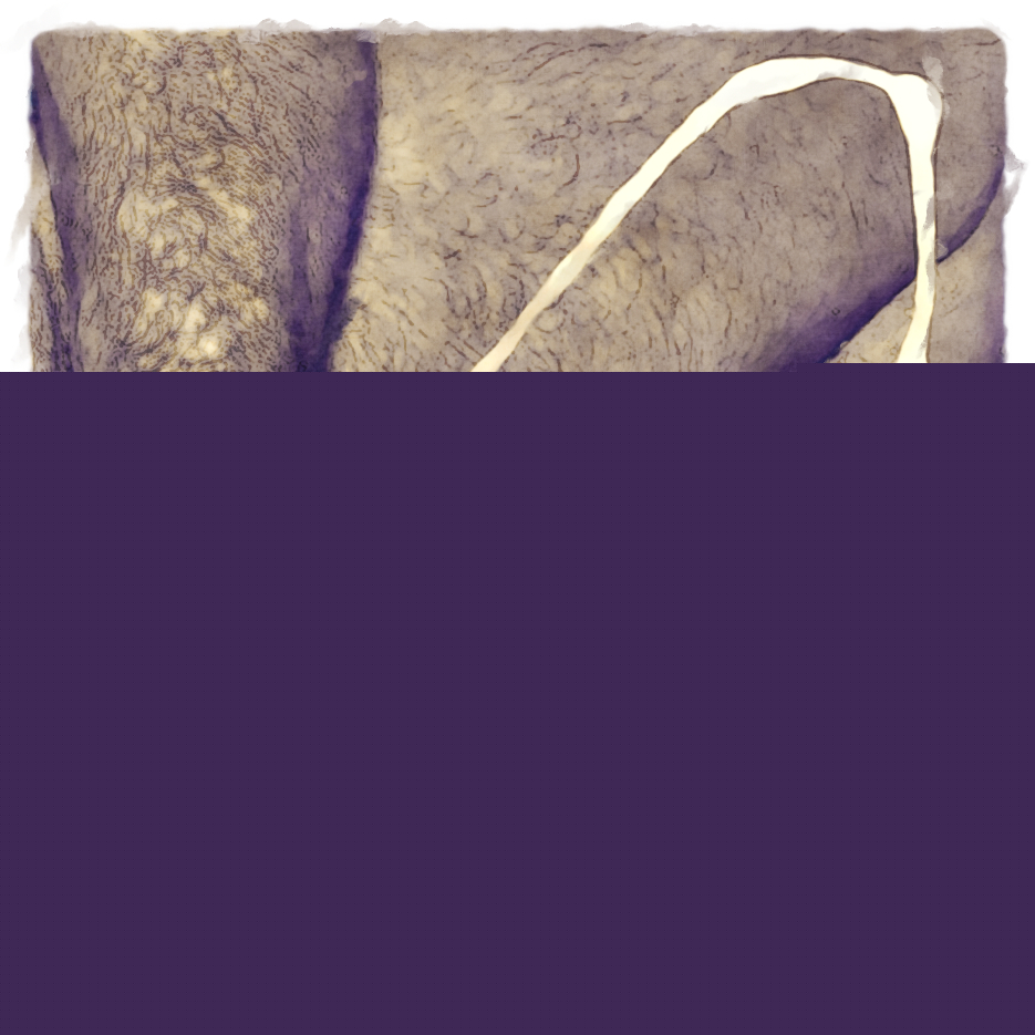 49