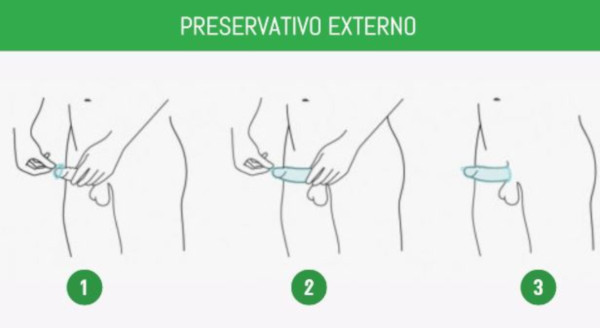 PreservativoExterno1